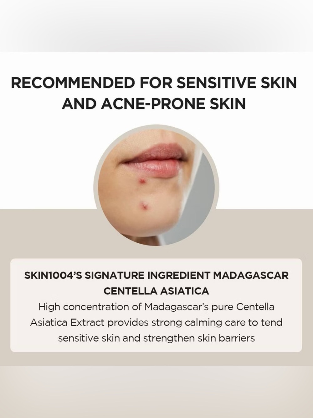 ✨ SKIN1004 Madagascar Centella Ampoule 100ml Soothing Hydrating Serum K-Beauty - Picture 4 of 7